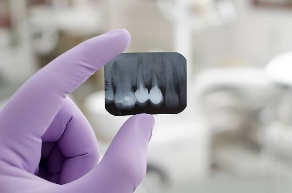 RADIOGRAPHY