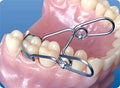 saddle clamp