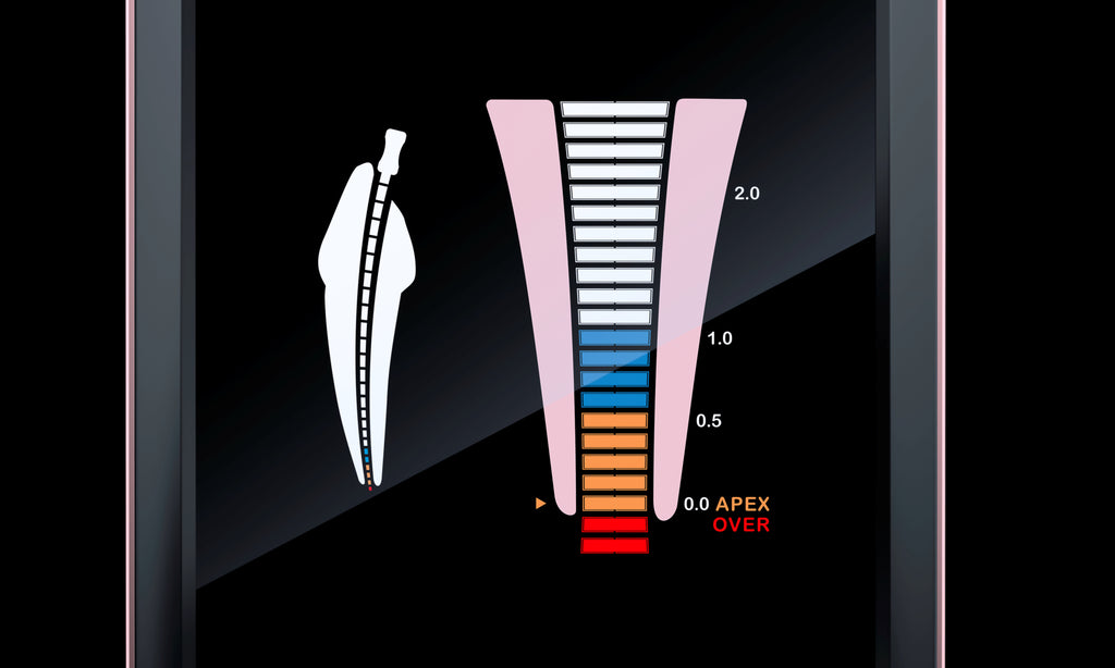 Woodpex V
