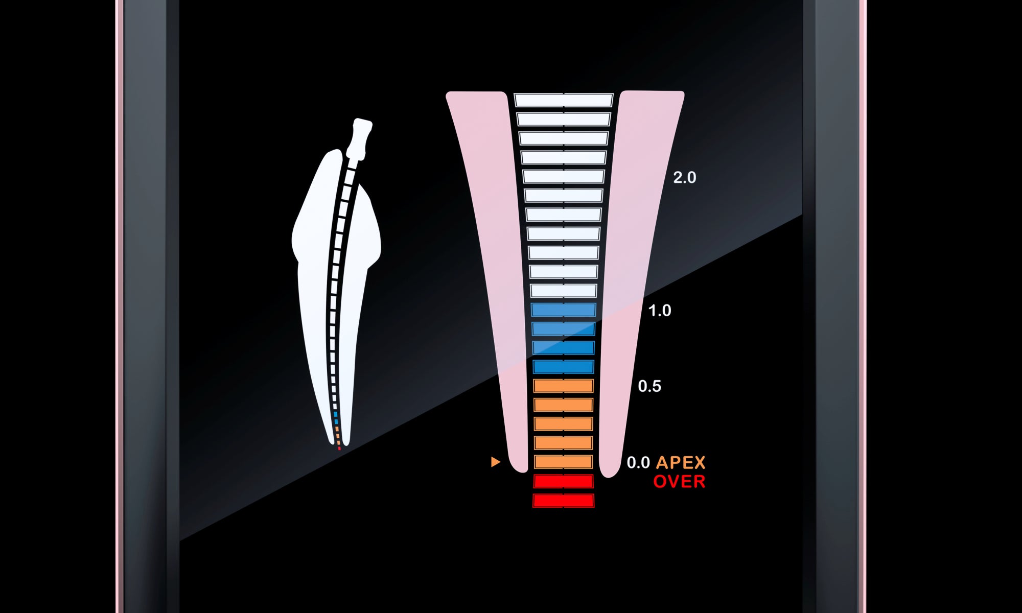 Woodpex V