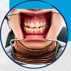 Origner Cheek Lip Retractor رتراكتر | EXLIN