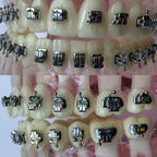 Self Ligating bracket (Passive)