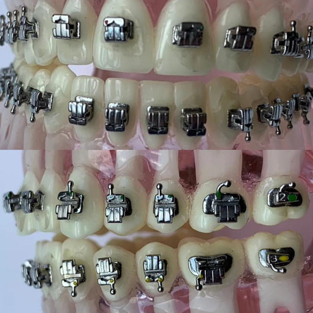 Self Ligating bracket (Passive)