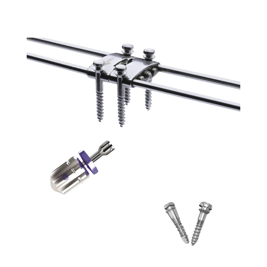 MARPE Miniscrew Assisted Rapid Palatal Expande| | IOSIOSr