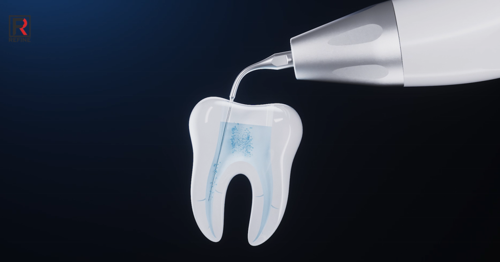 Tip of Ultrasonic Activator VAT-3 - REFINE - REFINE