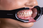 Lip Retractor V2  | INDUSBELLO