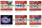 Blockdam Gingival barrier