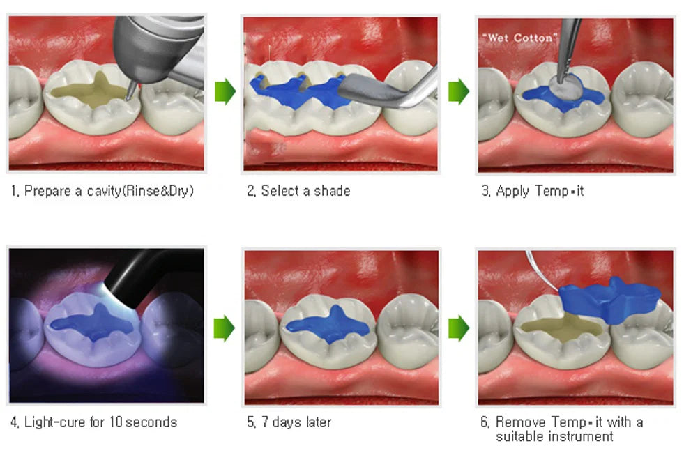 Blockdam Gingival barrier