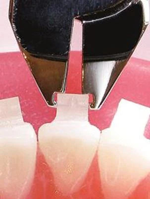 Ceramic Bracket Debonding plier| IOS