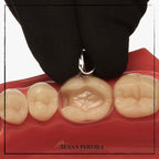TDV Polyester Matrix