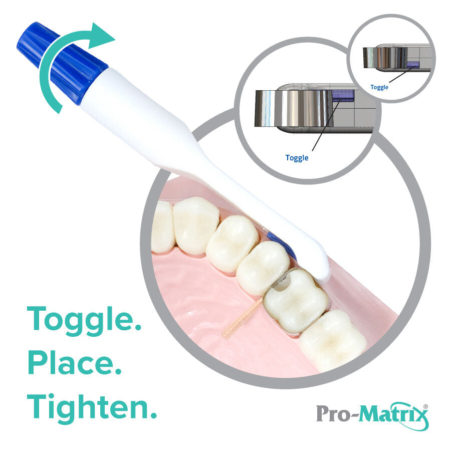 Pro-Matrix® Disposable Matrix System