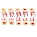 Molar Endo Block