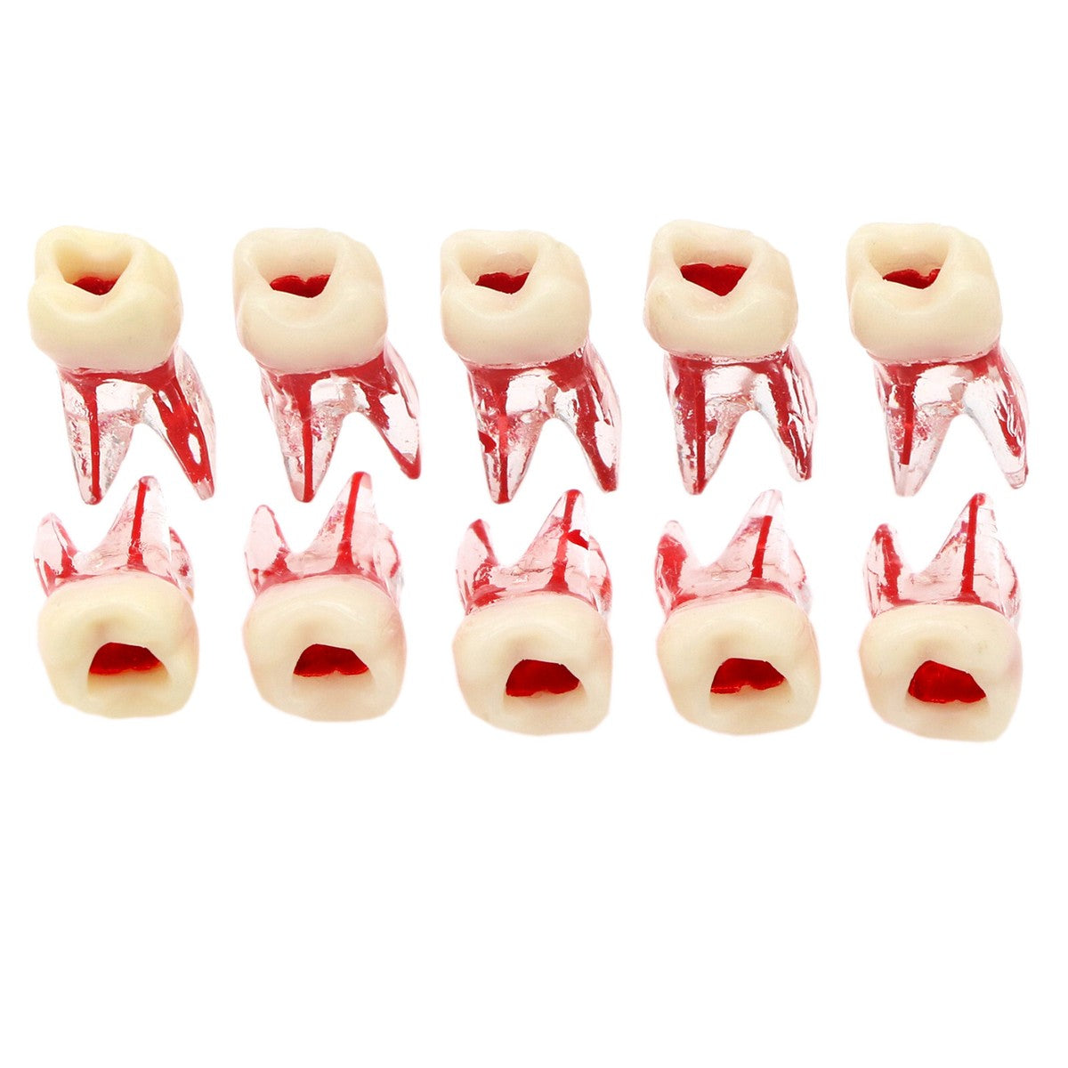 Molar Endo Block