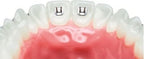 Tongue Spikes - PK/10| IOS